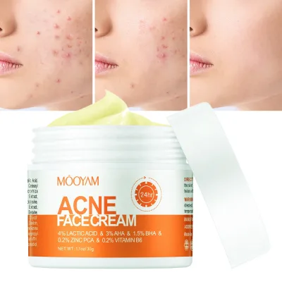 Private Label Acne Cream Helps Reduce Blemishes Calm Skin Skin Barrier Repair for Oily Acne Prone Skin Pimples Acne Cream