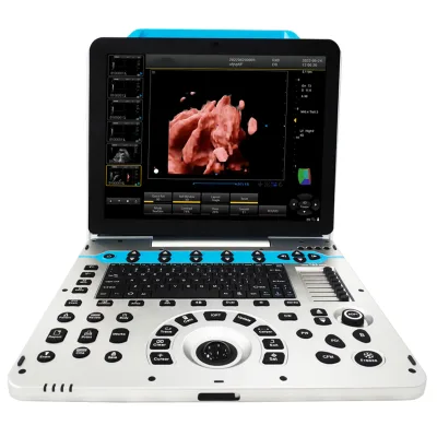 Medical Laptop 3D Color Ultrasound Scanner Support the Five Languages Portable Echocardiography Machine Ultrasound Probe Option