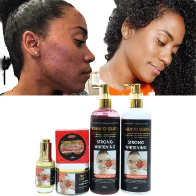 OEM Strong Bleaching Skin Care Set Glutathione Kojic Acid Vitamin C Tranexamic Acid Whitening Face Cream Body Lotion