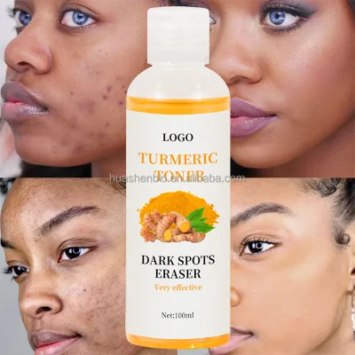 Private Label Organic Dark Spots Face Toner Eraser Corrector Skin Care Whitening Firming Acne Remove Facial Turmeric Toner