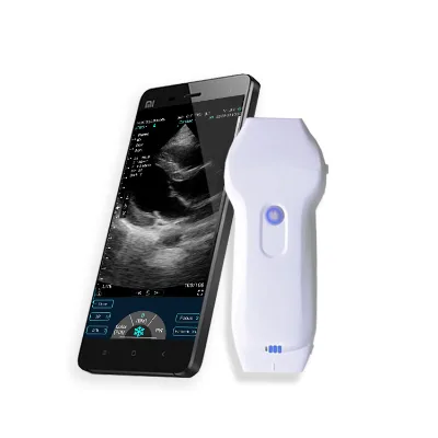 Big Promotion KONTED Color Doppler Ultrasound for Vascular &Heart