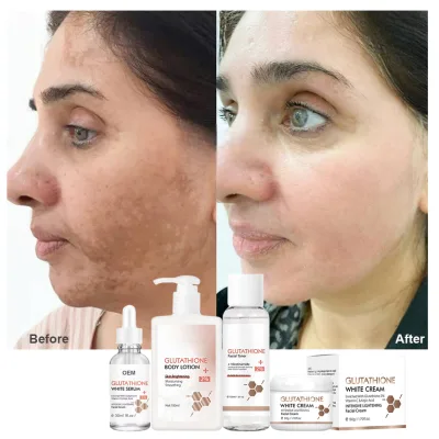 Strong Bleaching Cream Body Care Set Gluta Kojic Acid Skin Lightening Toner Face Wash Serum Removes Spots & Brightens Skin