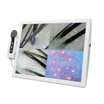 Scalp Hair Follice Detector Hair Skin Scalp Analyzer Beauty Machine 5 in 1 Scalp Hair Analyzer Equipment