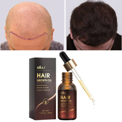 Hair Treatment Oil the Hair Diagram Edge Growth Oil for Black Hair for Men and Women