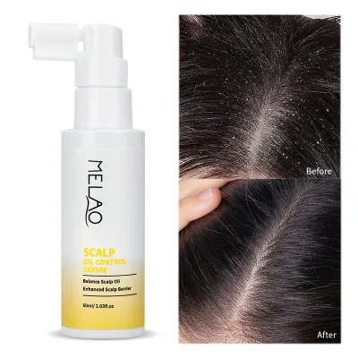 Anti Hair Loss Treatment Moisturizing Private Label OEM Hair Care Manufacturer Natural Repair Advanced Growth Scalp Serum