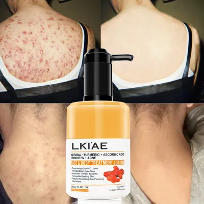 Effective Body Moisturizer OEM Whitening Brightening Back Body Anti-ance Turmeric Kojic Acid Glutathio Body Lotion