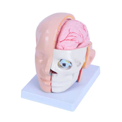 Human Head Model With Detachable Brain and Cerebral Artery
