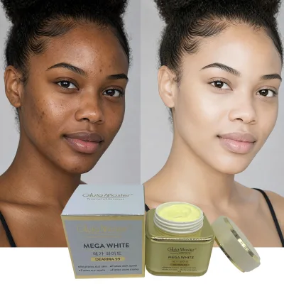 Gluta Master Moisturizing Face Cream 50g Fades Dark Spots Sun Spots Acne Marks Hydrating Cream Improve Dull Skin Tone
