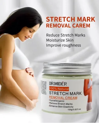 Hot Sale Moisturizing Pregnancy Cream Reduces and Fades Stretch Marks and Repairs Skin