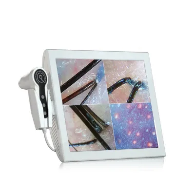 4 windows Laptop Type Skin Analyzer and Hair Scalp Follicle Enlarge Analysis Machine with Two Camera