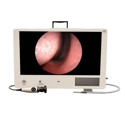 JOYMED Portable All-in-One Endoscopic Camera System with 4K Display and Recording Function Model JM24 Class I for Hospital Use
