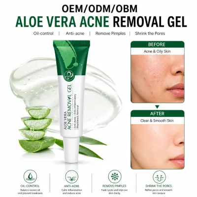 LAIKOU OEM/ODM/OBM Aloe Gel Cream 20g Face Moisturizing Hydrating Anti-acne Anti-inflammatory Facial Cream Gel