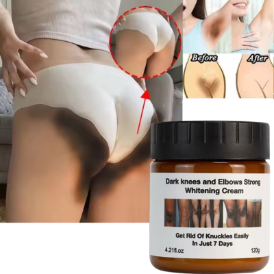 Private Label Extreme Whitening Anti Dark Spot Aging Wrinkle Knees Elbows Strong Vitamin White Lotion Face Body Whitening Cream