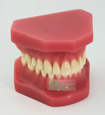 Dental Orthodontic Model Study Denture Model