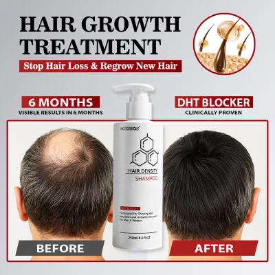 Organic Nutrient Infused Hair Growth Shampoo Stabilize Hair Root Anti Hair Fall Scalp Cleansing for Male Female Custom Logo