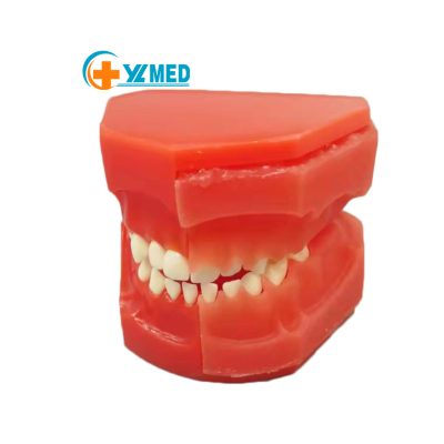 5 Years Old Deciduous Permanent Teeth Alternate Model Dentural Development Medical Anatomical for Model Educational Equipment