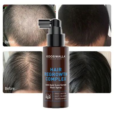 New Arrival Faster Repair Hair Growth Spray Natural Organic Hair Treatment Oil 100ml Volume Anti Hair Loss Serum