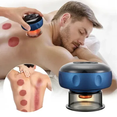 Rechargeable Smart Cupping Cups Therapy Massager Device Body Customized Logo Massage Ce Type C Cupping Machine Face Cupping Set