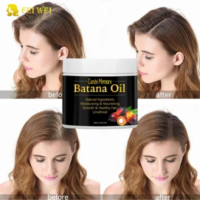 Hot Sale 100% Natural Pure Batana Oil for Hair Nourishment Prevents Hair Loss