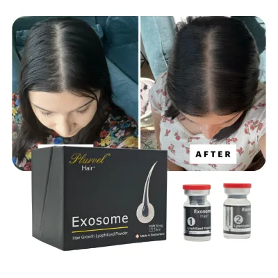 Exosoom Intense Whitening Glow Face Serum Dark Spot Corrector Melanin Block Skincare