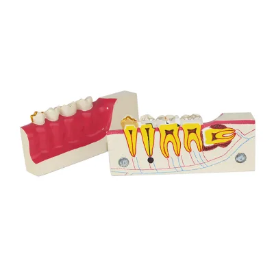 Lower Right Tooth Tissue Decomposition Model ZM1049-11/SMT023