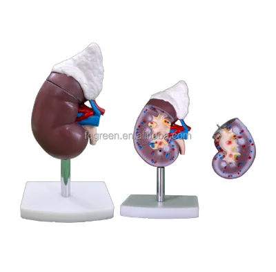 Detachable 2 Parts Human Kidney Anatomy Model For Medical School