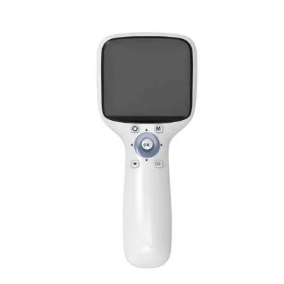 Portable Ophthalmic Handheld Digital Fundus Camera 42 Degree FOV HD Fundus Imaging Camera with 3.5 Inch TFT Color Screen