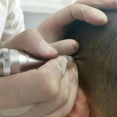 Permanent Make up pink Lips Permanent Microshading Micropigmentation for Scalp Micropigmentation Machine