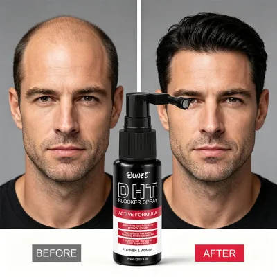 300ml DHT Blocker Shampoo and Conditioner Hair Thickening Shampoo and Hair Growth Spray Sulfate Free Hair Care Set