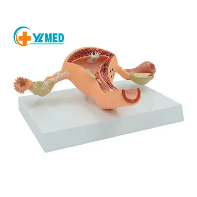 Educational Equipment Female Human Anatomy Uterine Lesion Model PVC Anatomical Model