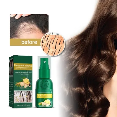 Ginger Hair Growth Oil Spray Scalp Massage Moisturizing Thick Hair Hair Care Nutrient Spray