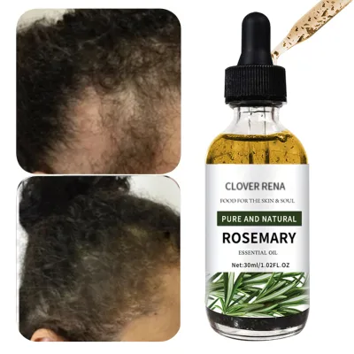 Customized Hair Growth Oil Natural Hair Growth Products Fast Regrowth Repair Nourishing Hair Growth Oil For Men And Women