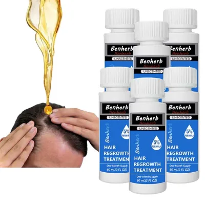 Hair Growth Oil Spray 5 Percent with Men Anti Hair Loss Original Custom Product 60ml Bottle Beard Regrowth