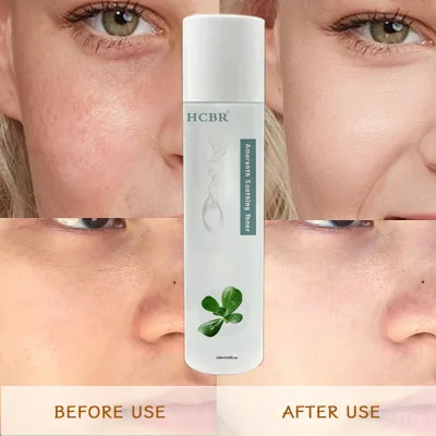 Centella Toner Dark Spots Eraser Brightening Skin Even Skin Tone Fades Blemishes Acne Remove Whitening Face Toner