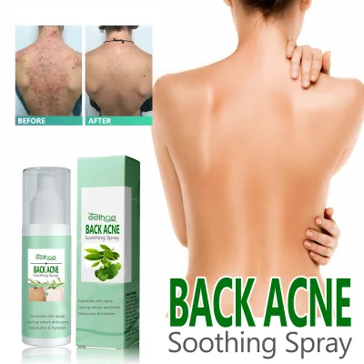 Organic Herbal Body Spray for Acne Repair Lightening Acne Marks and Smoothing Skin Body Acne Treatment Feature