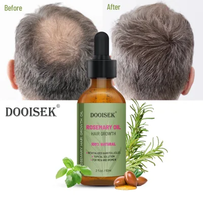 Oem Wholesale Natural Organic Rosemary Essential Oil Women Black Hair Care Products Rosemary Oil Hair Growth for Black Women