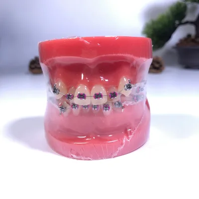 Study Dentist Anatomical Dental Typodont Full Metal Brackets Standard Orthodontic Model