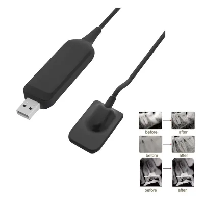 Digital X-Ray Dental Sensor Size 1 Size 2 Intraoral Digital Dental RVG X-Ray With Good Price