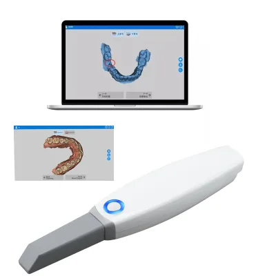 3D Intraoral Scanner Digital Impression Intra Oral Digital Scanner Wired Wireless Intraoral Scanner