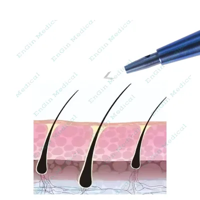 High Precision Sapphire Fue Knife Hair Transplant Tools Procedure Blade Microblade Instruments Kit Supplies
