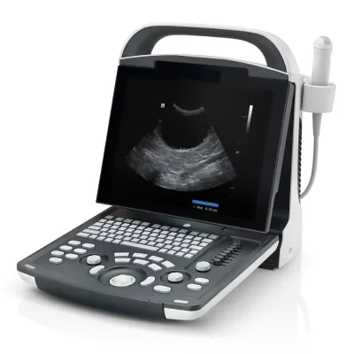 Portable Digital Ultrasonic Mindray DP20 Ultrasound Machine Original DP-20 Ultrasound Machine System Cheap Price