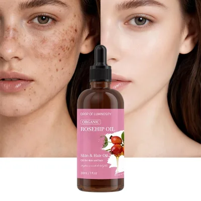 Private Label Anti Wrinkle Serum Organic Cold Pressed Pure Natural Rosehip Oil for Brightening