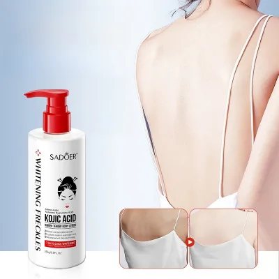 250g Body Skin Moisturizing Smooth Hydrating Quickly Whitening Kojic Acid Body Lotion