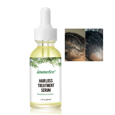 Private Label Rosemary Oil Private Label Custom Nourishing Repair Hair Growth Serum Hair Tonic Serum for Repair Hair