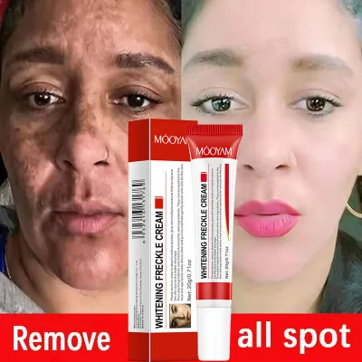 Brightening Face Cream for Uneven Skin Tone & Dullness