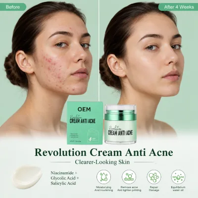 Gentle Oil Control Acne Scar Treatment Cream Calms Redness Improves Skin Tone Acne Cream for Acne Prone Skin Private Label