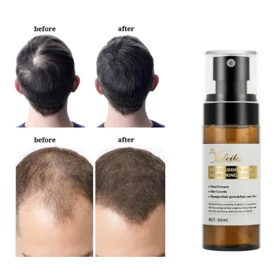 Oem Private Label Customize Rosemary Oil Hair Growth Organic Vegan Cruelty Free Rosemary Essential Oil