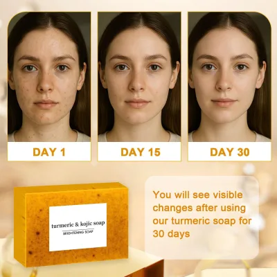 Professional Turmeric Soap Lightening Tablet Hyperpigmentation Correction Intense Glow Beauty Cleansing Pad Bulk