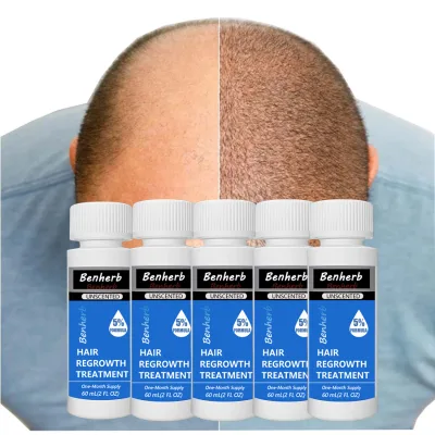 MN5% Hot Product Herbal Extract Rapid Growth Strengthening Repair Hair Growth Oil Treat Baldness