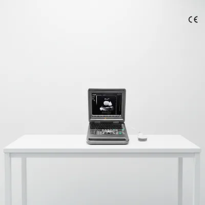 Basic Imaging 12 Inch Portable Ultrasound Device High Value 2D System for Clinics